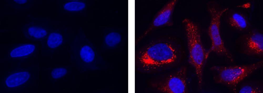 Fluorescence images of hydroxyl radical measurement in HeLa cells using MitoROS™ OH580 (Cat#16055). HeLa cells were incubated with MitoROS™ OH580 working solution at 37 °C for 1 hour, then washed once with HHBS. Fenton Reaction: Cells were then treated with 10 µM CuCl2 and 100 µM H<sub>2</sub>O<sub>2</sub> in 1X HBSS buffer at 37 °C for 1 hour. Control: HeLa cells were kept in 1X HBSS buffer without treatment. After washing 3 times with HHBS, HeLa cells were measured using a fluorescence microscope with a TRITC filter set (Red). Cell nuclei were stained with Hoechst 33342 (Cat#17530, Blue).
