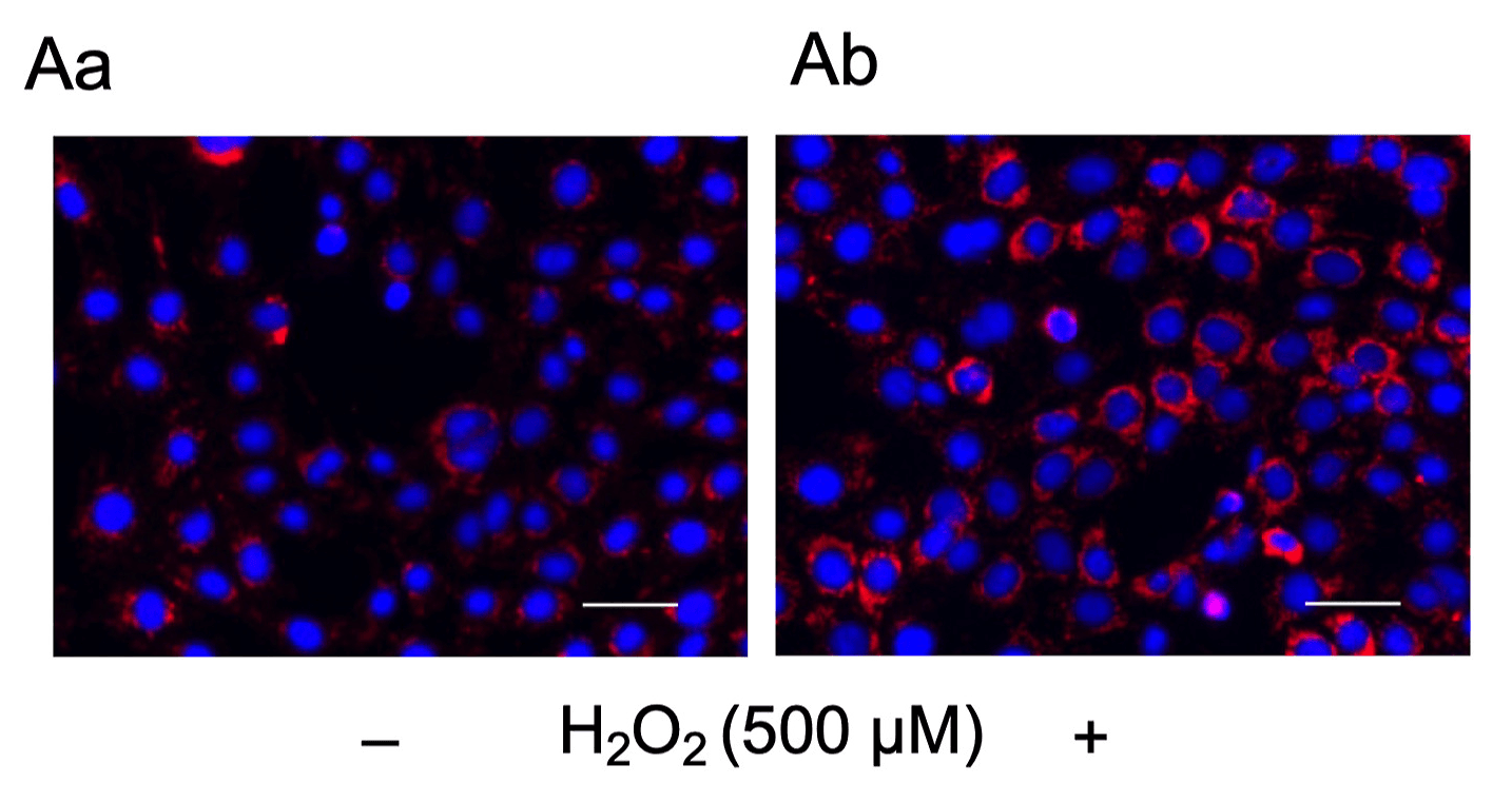 Antioxidant NAC partially and significantly reverses the H2O2-mediated increase in phosphorylation of ERK1/2 in FLS1 cells. (A) Cells were cultured (Aa) without or (Ab) with H2O2 (500 μM) for 24 h, and then OH∙ production in the cells was fluorescently visualized. Detection of hydroxyl radicals in FLS1 cells was performed using a Cell Meter™ mitochondrial hydroxyl radical (OH∙) detection kit under a fluorescence microscope. The nuclei were counter-stained with Hoechst 33342 (blue). Scale bar, 50 μm. Source: <b>Hydrogen peroxide-induced oxidative stress promotes expression of CXCL15/Lungkine mRNA in a MEK/ERK-dependent manner in fibroblast-like synoviocytes derived from mouse temporomandibular joint</b> by Asanuma, Kanna et.al., <em>Journal of Oral Biosciences</em>, March 2023