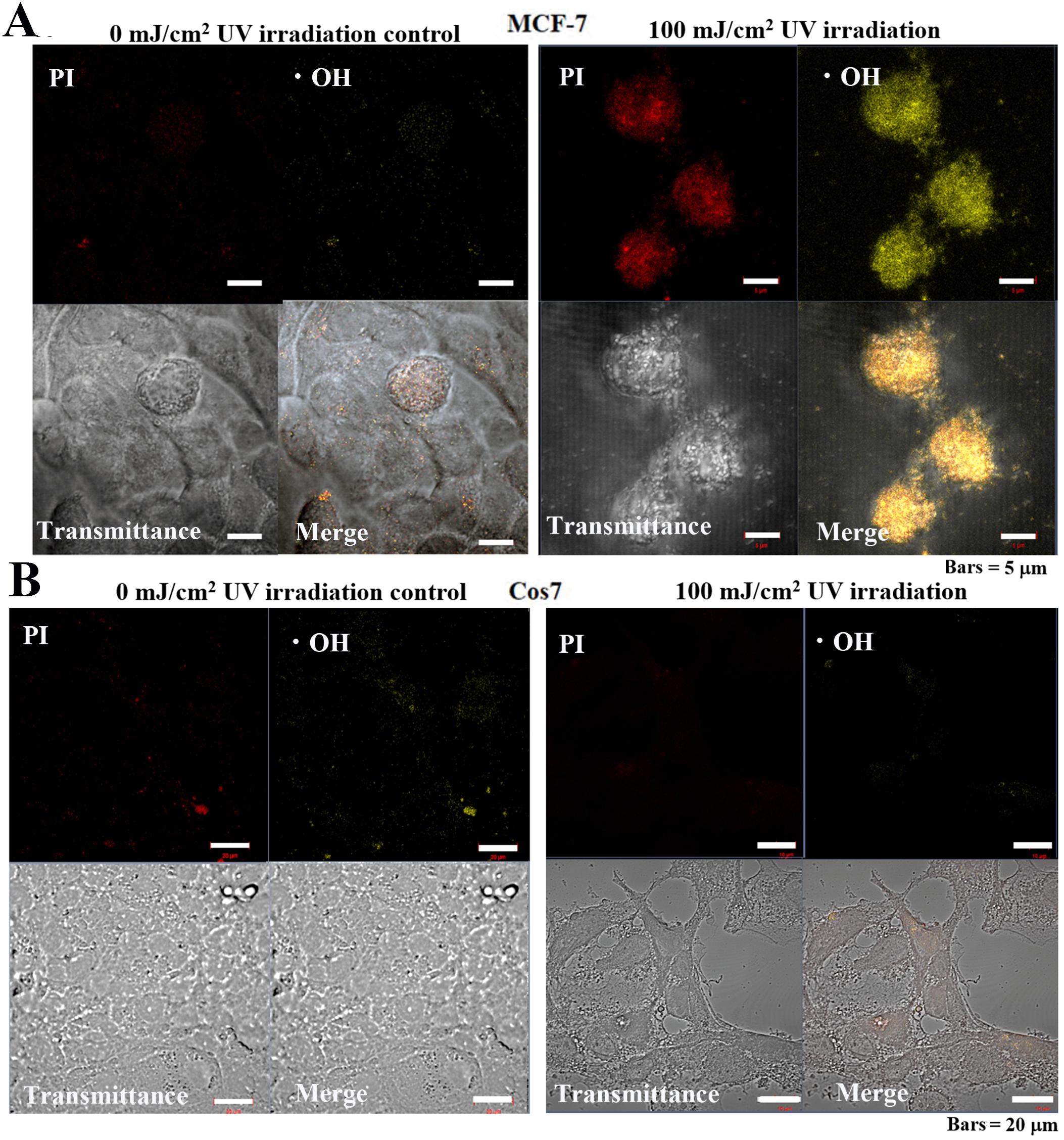Cellular mitochondrial ROS-OH580 activity under 24 h pulsed UV irradiation in MCF-7 and Cos7 cells. (A) The signal intensities of PI and ROS-OH580 in control MCF-7 cells were weakly distributed in the cytoplasm and nucleus. Bar = 5 μm. Cell atrophy and cytoplasmic lysis were observed in irradiated MCF-7 cells. Most cells were PI-positive (cell death), and the ROS-OH580 (•OH) signal was strongly detected in the nuclear enrichment. Bar = 5μm. (B) PI and ROS-OH580 (•OH) signal intensities in Cos7 cells were weakly distributed in the cytoplasm of control and irradiated Cos7 cells. Bar = 5μm. Source: <b>A New Drug-Free Cancer Therapy Using Ultraviolet Pulsed Irradiation. PDT (PhotoDynamic Therapy) to PPT (Pulsed Photon Therapy).</b> by Johbu Itoh, Yoshiko Itoh. <em>Front. Biosci. (Schol Ed)</em>, Sept. 2022.
