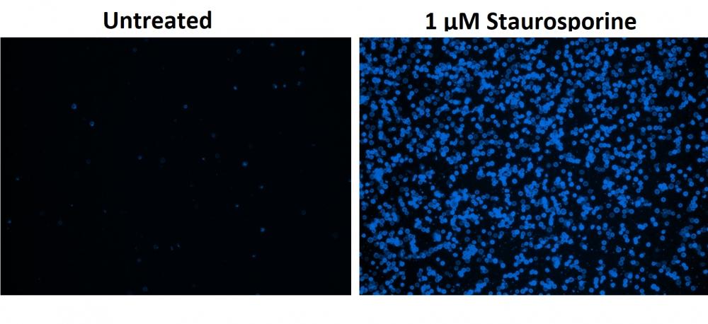 Fluorescence image of HeLa cells stained with Apopxin&trade; Violet 450 conjugate. Jurkat cells were treated without (Left) or with 1 &mu;M staurosporine (Right) at&nbsp;37 &ordm;C for 4 hours. The fluorescence intensity was measured using a microscope with a violet filter set (Excitation=405 nm).