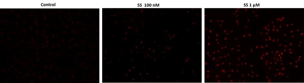 Fluorescence images of TUNEL reaction in HeLa cells with the treatment of 100 nM or 1 &mu;M staurosporine (SS) for 4 hours as compare to untreated control. Cells were incubated with TUNEL working solution for 1 hour at 37&ordm;C. The red fluorescence signal was analyzed using fluorescence microscope with a TRITC filter set. Fluorescently labeled DNA strand breaks shows intense fluorescent staining in SS treated cells.