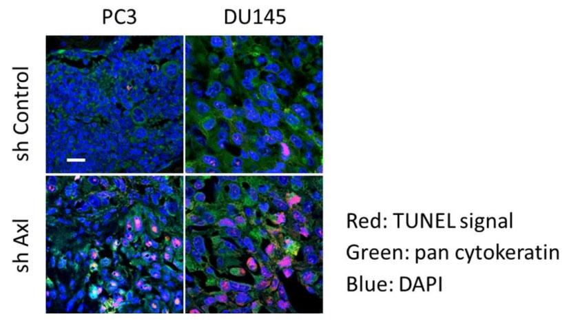 Apoptotic PCa cells in BM defined by TUNEL staining. PCa cells were recognized by pan cytokeratin with green color, and TUNEL signals were shown with red color. Scale bar, 20 &mu;m. Source: <strong>Axl is required for TGF-&beta;2-induced dormancy of prostate cancer cells in the bone marrow </strong>by Yumoto et al., <em>Scientific Reports</em>, Nov. 2016.