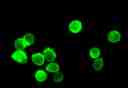 Fluorescence images of HL-60 cells stained with Cell Navigator® Cell Plasma Membrane Staining Kit *Green Fluorescence* in a 96-well black wall/clear bottom plate. The cells were imaged using a fluorescence microscope equipped with a FITC filter set.<br> 