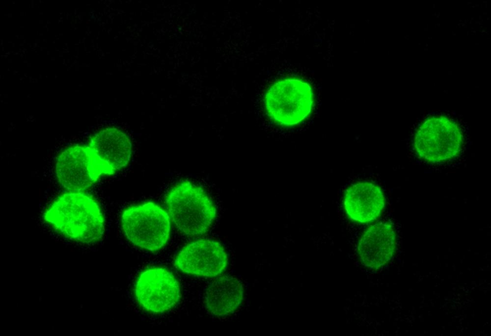 Fluorescence images of HL-60 cells stained with Cell Navigator® Cell Plasma Membrane Staining Kit *Green Fluorescence* in a 96-well black wall/clear bottom plate. The cells were imaged using a fluorescence microscope equipped with a FITC filter set.<br />&nbsp;