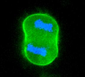 The fluorescence images of HL-60 cells by Cellpaint&trade; Green co-stained with &nbsp;Hoechst 33342 on a glass slide. The cells were imaged using fluorescence microscope using 60X oil lens with a FITC filter. <em>The images appeared to be more punctured and diffused since all the fluorescence signals from membranes both above and below the cell borders were indiscriminately captured. Compared to regular epifluorescence imaging, confocal fluorescence imaging is more sensitive and may give you more control than a regular epifluorescence microscope. If you have access to a confocal microscope, you may get a crisper imaging of cell membranes.</em>
