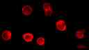 Fluorescence images of HL-60 cells stained with Cell Navigator® Cell Plasma Membrane Staining Kit *Orange Fluorescence* in a 96-well black wall/clear bottom plate. The cells were imaged using a fluorescence microscope equipped with a TRITC filter.