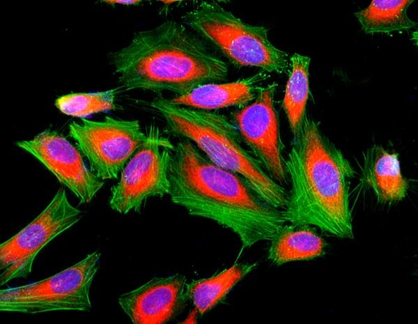 Fluorescence image of HeLa cells fixed with 4% formaldehyde then stained with Cell Navigator® F-Actin Labeling Kit *Green Fluorescence* in a Costar black 96-well plate. Cell were labeled with iFluor® 488-Phalloidin (Cat#22261, Green) and nuclei stain DAPI (Cat#17507, Blue), respectively. Cell endoplasmic reticulum (ER) was stained with ER Red™ (Cat#22636, Red) before fixation.