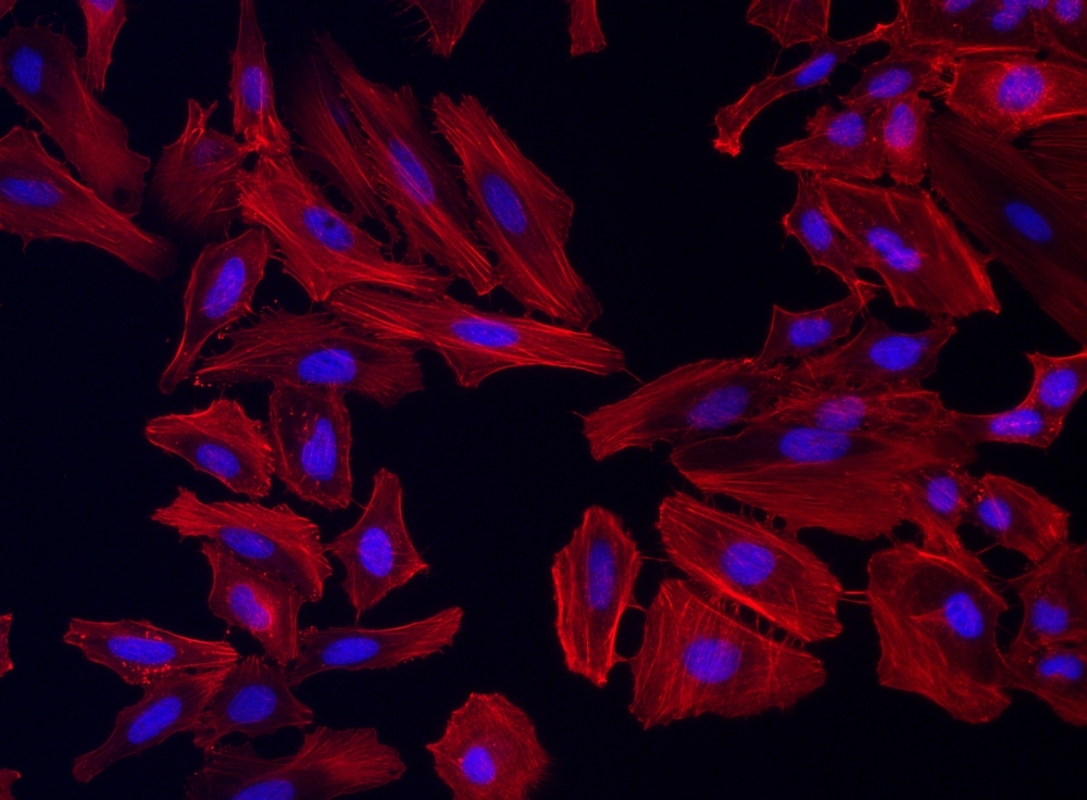 Fluorescence image of HeLa cells fixed with 4% formaldehyde then stained with Cell Navigator® F-Actin Labeling Kit *Orange Fluorescence* in a Costar black 96-well plate. Cells were labeled with iFluor® 546-Phalloidin (Cat#22663, Red) and nuclei stain DAPI (Cat#17507, Blue), respectively. 