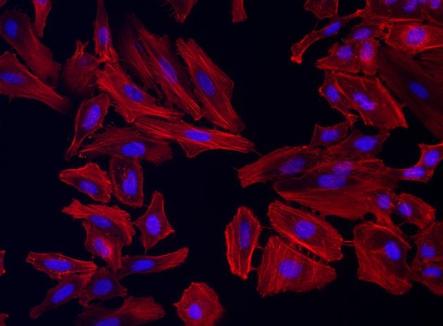Fluorescence image of HeLa cells fixed with 4% formaldehyde then stained with Cell Navigator® F-Actin Labeling Kit *Orange Fluorescence* in a Costar black 96-well plate. Cells were labeled with&nbsp;iFluor® 546-Phalloidin (Cat#22663, Red) and nuclei stain DAPI (Cat#17507, Blue), respectively. &nbsp;
