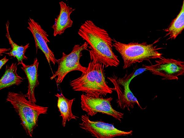 Fluorescence image of HeLa cells fixed with 4% formaldehyde then stained with Cell Navigator® F-Actin Labeling Kit *Red Fluorescence* in a Costar black 96-well plate. Cells were labeled with iFluor® 594-Phalloidin (Cat#22664, Red) and nuclei stain DAPI (Cat#17507, Blue), respectively. Cell endoplasmic reticulum (ER) was stained with ER Green™ (Cat#22635, Green) before fixation.