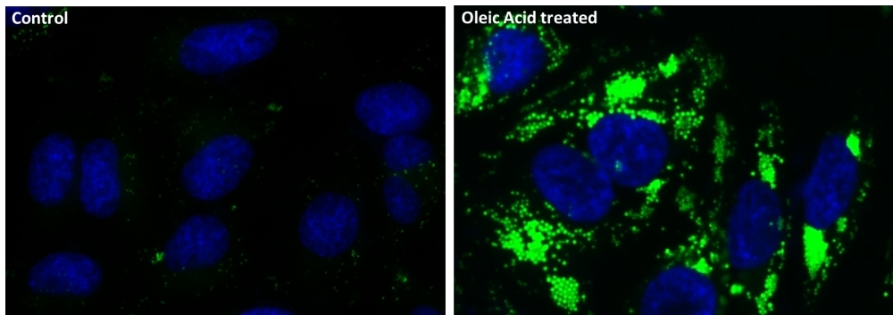 Fluorescence images of intracellular lipid droplets in control (Left) and Oleic Acid treated HeLa cells (Right) using Cell Navigator® Lipid Droplets Fluorescence Assay Kit. HeLa cells were incubated with 300 uM of Oleic Acid for 24 hours to induce intracellular lipid droplets formation. After washing with PBS, the cells were labeled with 1X Nile Green™ and Hoechst 33342 (Cat#17533).