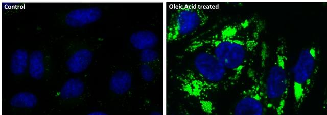 Fluorescence images of intracellular lipid droplets in control (Left) and Oleic Acid treated HeLa cells (Right) using Cell Navigator® Lipid Droplets Fluorescence Assay Kit. HeLa cells were incubated with 300 uM of Oleic Acid for 24 hours to induce intracellular lipid droplets formation. After washing with PBS, the cells were labeled with 1X Nile Green&trade; and Hoechst 33342 &nbsp;(Cat#17533).