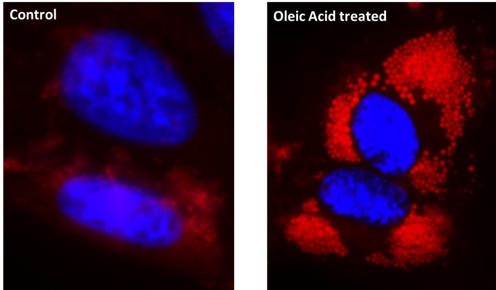 <p>Fluorescence images of intracellular lipid droplets in control (Left) and Oleic Acid treated HeLa cells (Right) using Cell Navigator® Lipid Droplets Fluorescence Assay Kit. HeLa cells were incubated with 300 uM of Oleic Acid for 24 hours to induce intracellular lipid droplets formation. After washing with PBS, the cells were labeled with 1X Droplite™ Red and Hoechst 33342  (Cat#17533).</p>
