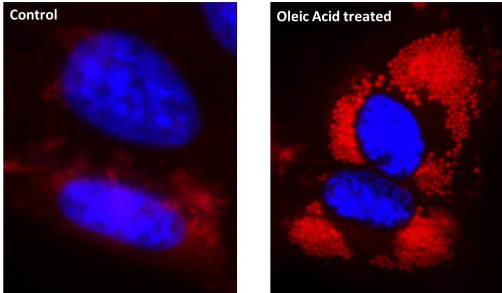 Fluorescence images of intracellular lipid droplets in control (Left) and Oleic Acid treated HeLa cells (Right) using Cell Navigator® Lipid Droplets Fluorescence Assay Kit. HeLa cells were incubated with 300 uM of Oleic Acid for 24 hours to induce intracellular lipid droplets formation. After washing with PBS, the cells were labeled with 1X Droplite&trade; Red and Hoechst 33342 &nbsp;(Cat#17533).