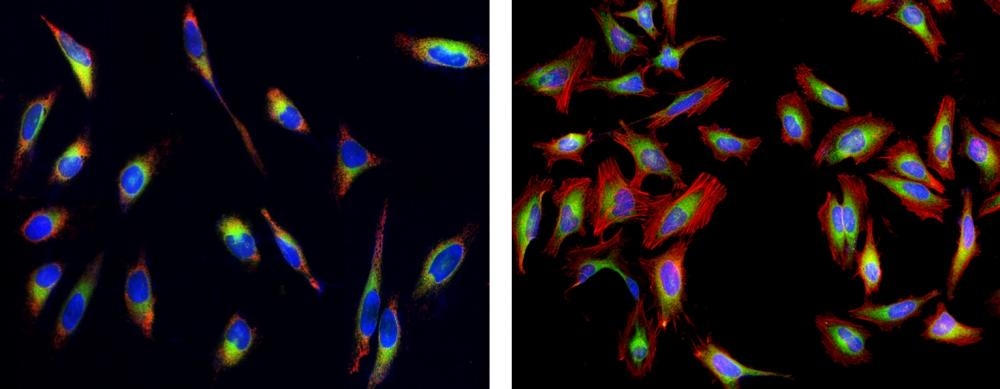 Fluorescence images of endoplasmic reticulum (ER) staining in HeLa cells cultured in a 96-well black-wall clear-bottom plate using fluorescence microscope with a FITC filter set. Left: Live cells were stained with ER-selective probe ER Tracer™ Green (Cat#22635, Green), mitochondria dye MitoLite™ Red FX600 (Cat#22677, Red) and nuclei stain Hoechst 33342 (Cat#17530, Blue). Right: Live cells stained with ER Tracer™ Green (Cat#22635, Green) were fixed with 4% formaldehyde, and labeled with F-actin dye iFluor® 594-Phalloidin (Cat#23122, Red) and nuclei stain DAPI (Cat#17507, Blue).