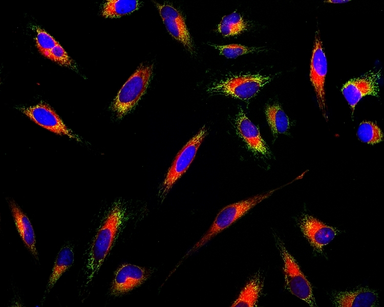Fluorescence images of endoplasmic reticulum (ER) staining in HeLa cells cultured in a 96-well black-wall clear-bottom plate using a fluorescence microscope equipped with a TRITC filter set. Live cells were stained with Cell Navigator® Live Cell Endoplasmic Reticulum (ER) Staining Kit *Red Fluorescence* (Cat#22636, Red), mitochondria dye MitoLite™ Green (Cat#22675, Green), and nuclei stain Hoechst 33342 (Cat#17530, Blue).
