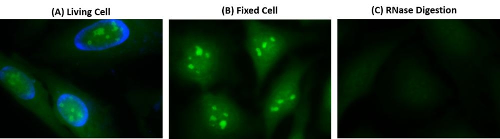 Fluorescence images of RNA staining in HeLa cells. (A) Live cells were stained using Cell Navigator® Live Cell RNA Imaging Kit (Green, Cat#22630) and counter-stained with Hoechst 33342 (Blue, Cat#17530). (B) Cells fixed in methanol were stained using the same kit. (C) After staining, fixed HeLa cells were incubated with 0.5 mg/mL RNase at 37 ºC for 1 hour. Image of RNase digest test indicates the high selectivity of StrandBrite™ RNA Green. The green fluorescence signal were measured using a fluorescence microscope with a FITC filter.