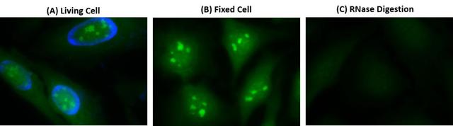 Fluorescence images of RNA staining in HeLa cells. (A) Live cells were stained using Cell Navigator® Live Cell RNA Imaging Kit (Green, Cat#22630) and counter-stained with Hoechst 33342 (Blue, Cat#17530). (B) Cells fixed in methanol were stained using the same kit. (C) After staining, fixed HeLa cells were incubated with 0.5 mg/mL RNase at 37 ºC for 1 hour. Image of RNase digest test indicates the high selectivity of StrandBrite™ RNA Green. The green fluorescence signal were measured using a fluorescence microscope with a FITC filter.