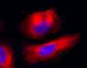 Imaging of tubulins in live HeLa cells. HeLa cells were co-labelled with Tubulite<sup>TM</sup> Red and DAPI (Cat# 17507) for 60 minutes in a 37 <sup>o</sup>C, 5% CO<sub>2</sub> incubator. The fluorescence image was taken with a fluorescence microscope (Cy5 filter set).