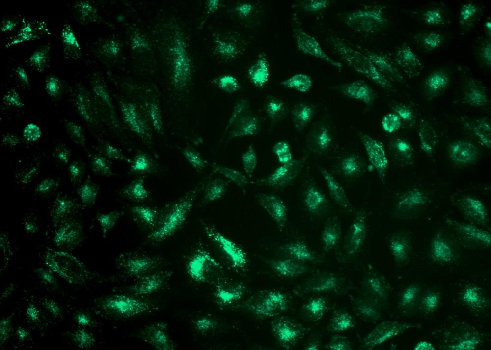 Image of U2OS cells stained with Cell Navigator® Lysosomal Staining Kit in a Costar black wall/clear bottom 96-well plate.