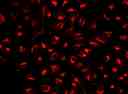 Image of HeLa cells stained with Cell Navigator® Lysosome Staining Kit in a Costar black wall/clear bottom 96-well plate.