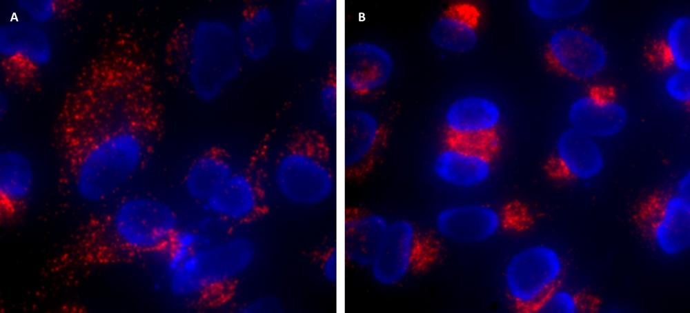 Lysosome localization and motility is altered for starvation-induced Hela cells. A: Healthy untreated  Hela cells. Lysosomes (Red) were dispersed widely throughout the cytosol in cells.  B: Starved Hela Cells. The cells were starved for 24 hours (no serum), and lysosomes were aggregated in the perinuclear region. Nuclei were stained with Hoechst 33342.