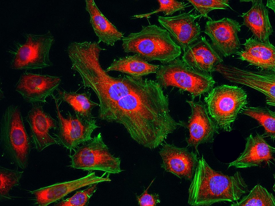 <p>Fluorescence images of HeLa cells stained with Cell Navigator® Mitochondrion Staining Kit *Deep Red Fluorescence* using fluorescence microscope with a Cy5 filter set. Live cells were stained with mitochondria dye MitoLite™ Deep Red (Red). After fixation, the cells were labeled with F-actin dye iFluor® 488-Phalloidin (Cat#23115, Green) and counterstained with Nuclear Blue™ DCS1 (Cat#17548, Blue).</p>
