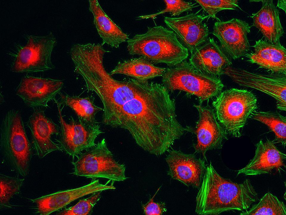 Fluorescence images of HeLa cells stained with Cell Navigator® Mitochondrion Staining Kit *Deep Red Fluorescence* using fluorescence microscope with a Cy5 filter set. Live cells were stained with mitochondria dye MitoLite™ Deep Red (Red). After fixation, the cells were labeled with F-actin dye iFluor® 488-Phalloidin (Cat#23115, Green) and counterstained with Nuclear Blue™ DCS1 (Cat#17548, Blue).