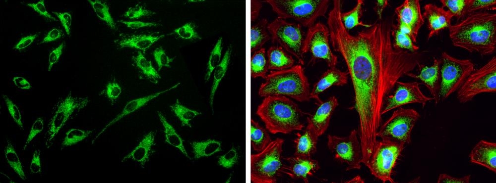 <p>Fluorescence images of HeLa cells stained with Cell Navigator® Mitochondrion Staining Kit *Green Fluorescence*. Live cells were stained with mitochondria dye MitoLite™ Green (Green) and imaged using fluorescence microscope with a FITC filter set. After fixation in 4% formaldehyde, the cells were labeled with F-actin dye iFluor® 633-Phalloidin (Cat#23125, Red) and counterstained with Nuclear Blue™ DCS1 (Cat#17548, Blue).</p>