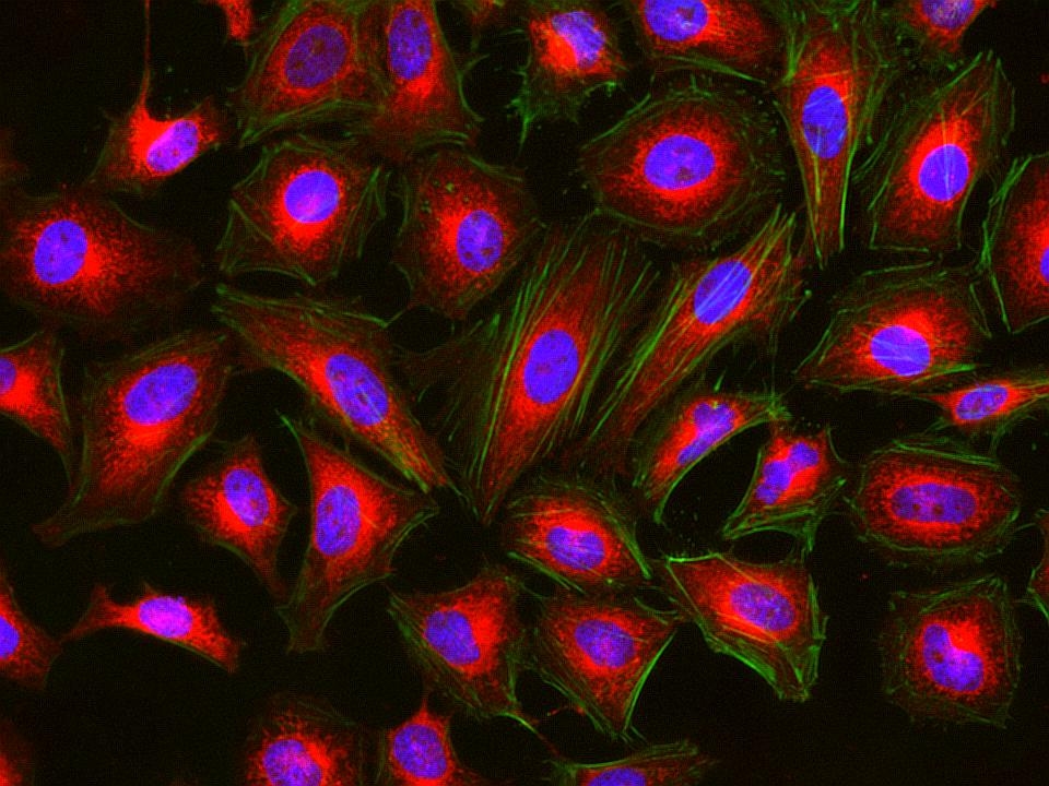 <p>Fluorescence images of HeLa cells stained with Cell Navigator® Mitochondrion Staining Kit *Orange Fluorescence* using fluorescence microscope with a TRITC filter set. Live cells were stained with mitochondria dye MitoLite™ Orange (Red) and imaged. After fixation, the cells were labeled with F-actin dye iFluor® 488-Phalloidin (Cat#23115, Green) and counterstained with Nuclear Blue™ DCS1 (Cat#17548, Blue).</p>