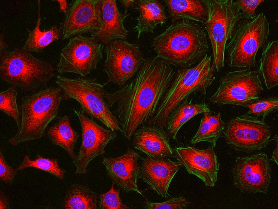 Fluorescence images of HeLa cells stained with Cell Navigator® Mitochondrion Staining Kit *Orange Fluorescence* using fluorescence microscope with a TRITC filter set. Live cells were stained with mitochondria dye MitoLite™ Orange (Red) and imaged. After fixation, the cells were labeled with F-actin dye iFluor® 488-Phalloidin (Cat#23115, Green) and counterstained with Nuclear Blue™ DCS1 (Cat#17548, Blue).