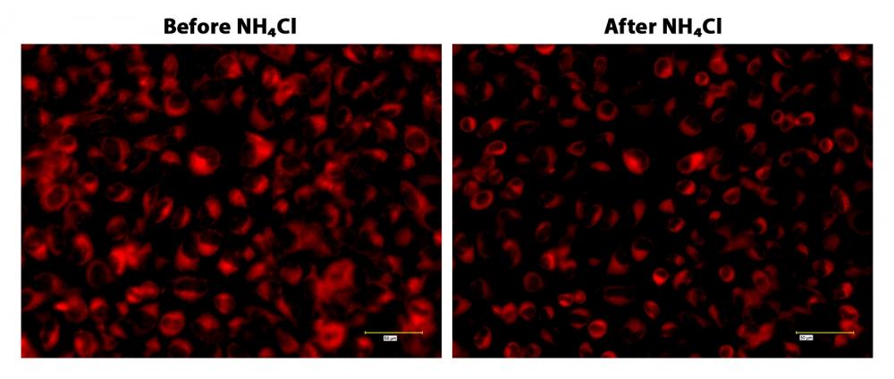 <strong>The representative fluorescence images of GGR169 Ceramide Golgi Staining in HeLa cells in a pH dependent manner.</strong> HeLa cells were stained with 100 &micro;L of GGR169-ceramide working solution at 37 &deg;C for 20 minutes. Images were acquired using a fluorescence microscope equipped with Cy3 filter set &nbsp;before and after the addition of 30 mM of NH<sub>4</sub>Cl solution. A reduction in fluorescence intensity was observed after the addition of NH<sub>4</sub>Cl.