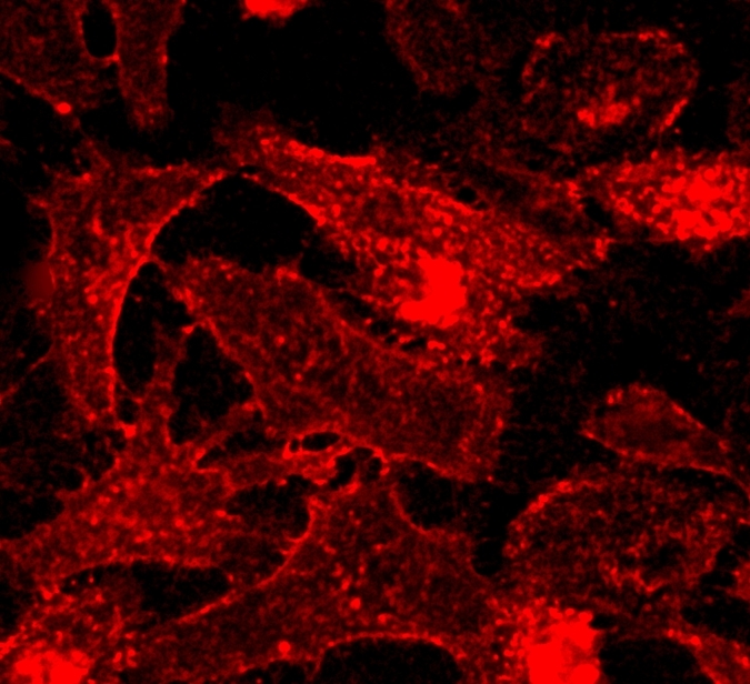 HeLa cells were labeled with CellPaint™ TSP membrane stain (Cat No. 22700). Labeled cells were imaged on the Keyence BZ-X710 All-In-One Fluorescence Microscope equipped with a Cy3/TRITC filter set.