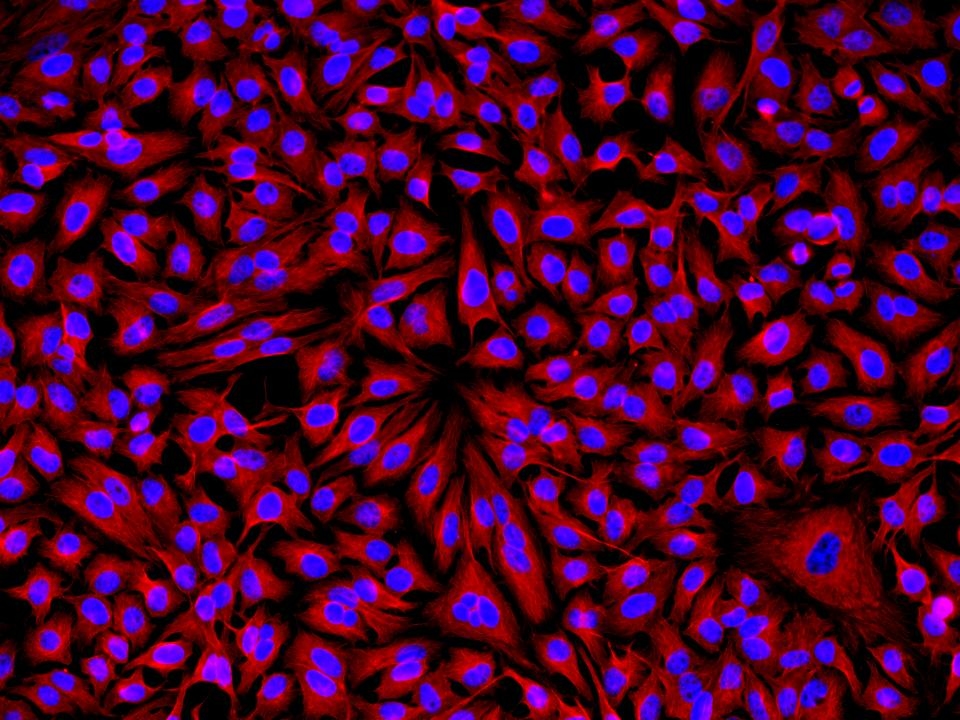 <p>HeLa cells were incubated with rabbit anti-tubulin followed by Cy3<sup>®</sup> goat anti-rabbit IgG conjugate. Cell nuclei were stained with Hoechst 33342 (Blue, Cat# 17530).</p>