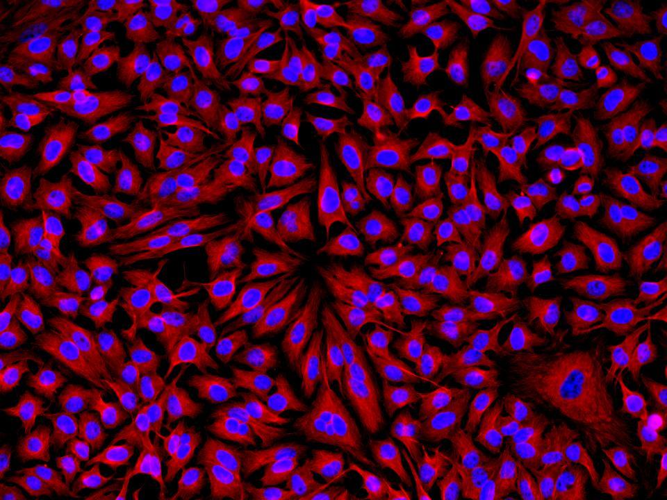 HeLa cells were incubated with rabbit anti-tubulin followed by Cy3<sup>®</sup> goat anti-rabbit IgG conjugate. Cell nuclei were stained with Hoechst 33342 (Blue, Cat# 17530).