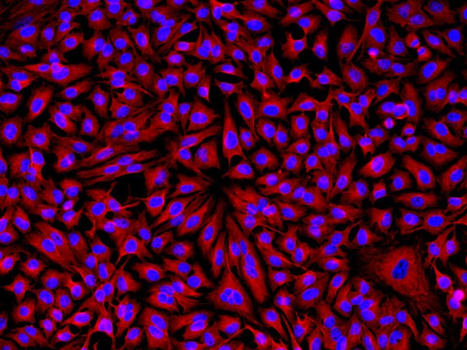 HeLa cells were incubated with rabbit anti-tubulin followed by Cy3® goat anti-rabbit IgG conjugate. Cell nuclei were stained with Hoechst 33342 (Blue, Cat# 17530).