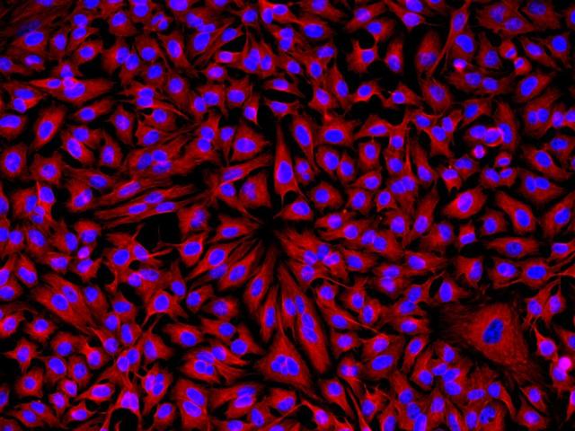 HeLa cells were incubated with rabbit anti-tubulin followed by Cy3® goat anti-rabbit IgG conjugate. Cell nuclei were stained with Hoechst 33342 (Blue, Cat# 17530).