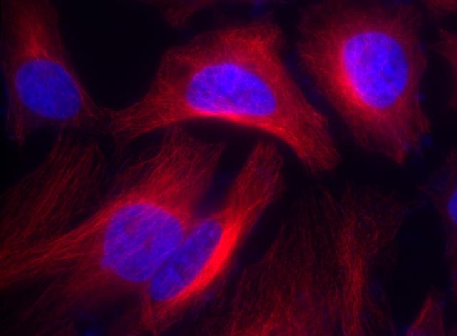 HeLa cells were incubated with rabbit anti-tubulin followed by Cy5® goat anti-rabbit IgG (H+L). Cell nuclei were stained with Hoechst 33342 (Blue, Cat# 17530).