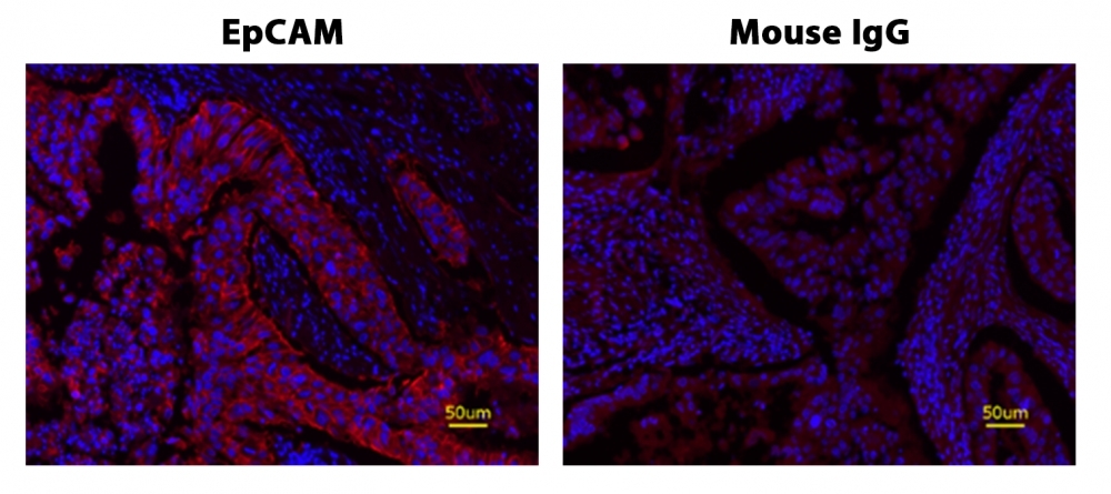 Fluorescence IHC of formaldehyde-fixed, paraffin-embedded human lung adenocarcinoma positive tissue using PSA<strong> ™</strong> amplified methods. Human lung adenocarcinoma positive tissue sections were stained with Mouse anti-EpCAM or Control Mouse IgG antibody and then incubated with polyHRP-labeled Goat anti-Mouse IgG secondary antibody followed by Cy7 Styramide™ (Cat#45066).