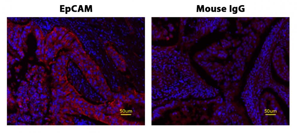 Fluorescence IHC of formaldehyde-fixed, paraffin-embedded human lung adenocarcinoma positive tissue using PSA<strong>&nbsp;&trade;</strong>&nbsp;amplified methods. Human lung adenocarcinoma positive tissue sections were stained with&nbsp;Mouse anti-EpCAM or Control Mouse IgG antibody and then incubated with polyHRP-labeled Goat anti-Mouse IgG secondary antibody followed by Cy7 Styramide&trade; (Cat#45066).