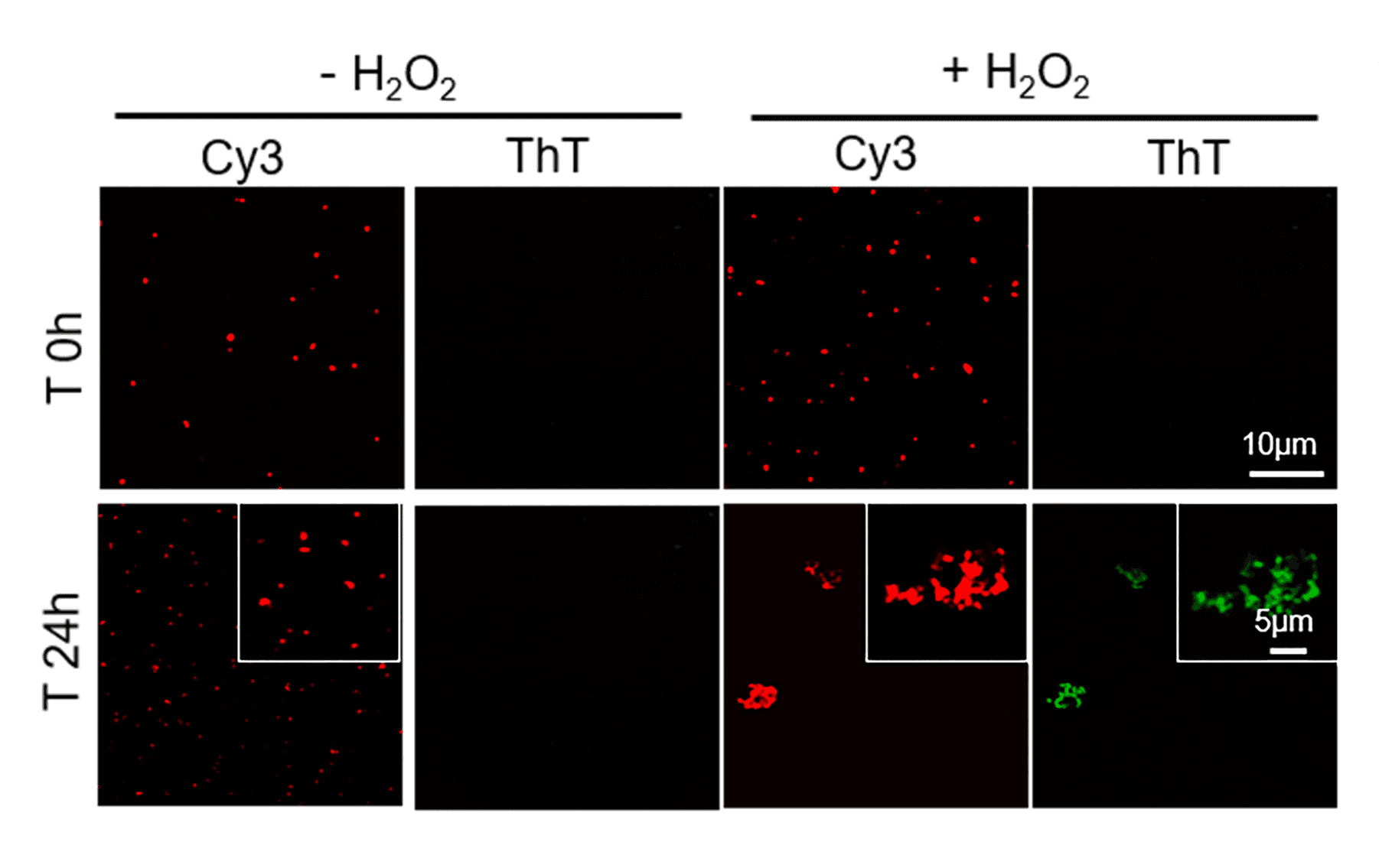 H2O2 promotes SOD1 phase separation. Confocal microscopy images of SOD1(100 μM, 15% PEG) colocalized with 20 μM ThT in the presence or absence of 1 mM H2O2 (at room temperature for 24 h). Scale bar represents 10 μm. Source: Figure from <b>A liquid-to-solid phase transition of Cu/Zn superoxide dismutase 1 initiated by oxidation and disease mutation</b> by Gu et al. <em>Journal of Biological Chemistry</em>, Feb. 2023.