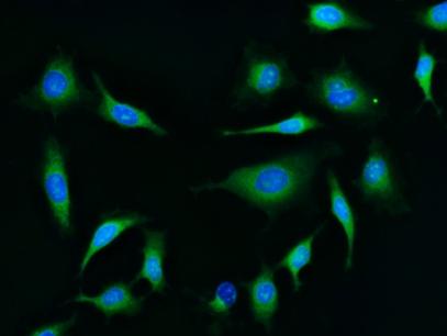Images of Live HeLa cells stained with CytoCalcein Violet 500 (Cat.22013). Cell nuclei were stained with Hoechst 33342 (Blue, Cat#17535).