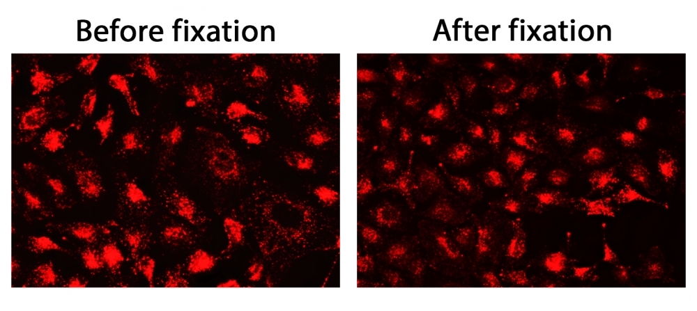 The fluorescence images of HeLa cells stained with CytoFix™ LysoRed in a 96-well black-wall clear-bottom plate. Image was acquired before (Left) and after (Right) fixation with 4% formaldehyde solution for 20 minutes at RT. The cells were imaged using fluorescence microscope with a Cy3/TRITC filter.<br> 