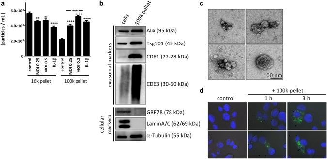 <em>L. pneumophila</em> infection increases the secretion of EVs in THP-1 cells. (a) Amount of EVs in response to <em>L. pneumophila</em> infection. THP-1 cells were treated with IL-1&beta; (1&thinsp;ng/mL) or infected with <em>L. pneumophila</em> (MOI 0.25 or 0.5, respectively) for 24&thinsp;h. NTA was performed with the distinct particle fractions separated by differential centrifugation. (b) Western blot for exosomal marker proteins. Whole cell lysate or 100&thinsp;k pellet derived from uninfected THP-1 cells were used. Equal protein amounts were loaded. (c) Transmission electron microscopy with 100&thinsp;k pellet. Purified EVs from THP-1 cells were fixed and visualized after negative staining with uranyl acetate. Scale bar represents 100&thinsp;nm. (d) Uptake of A549-derived EVs by THP-1 cells. A549 cells were stained with the membrane dye PKH67. EVs were collected (100&thinsp;k pellet) and incubated with THP-1 cells for 1 or 3&thinsp;h, respectively. Nuclei were stained by DAPI and pictures were taken with an original magnification of 630x. A: Data are shown as mean&thinsp;+&thinsp;SEM of three independent experiments. **p&thinsp;&lt;&thinsp;0.01, ***p&thinsp;&lt;&thinsp;0.001, ****p&thinsp;&lt;&thinsp;0.0001. B&ndash;D: representative results. Source: <strong><em>Legionella pneumophila</em> infection activates bystander cells differentially by bacterial and host cell vesicles </strong>by Jung et al., <em>Scientific Reports,</em> July 2017.