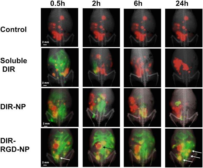 Enhanced retention and better colocalization <em>in vivo</em> with DIR-RGD-NP. Upon establishment of tumors (ROI~40,000), mice were given four doses of soluble DIR, DIR-NP, or DIR-RGD-NP given every other day. mCherry (red) and DIR (green) fluorescent images were obtained in live animals at designated time points 24 h after the 4th dose. Images shown are merged images demonstrating the best colocalization of mCherry and DIR signals (yellow) in animals that received DIR-RGD-NP. A representative animal for each delivery system is shown; (n = 4 for soluble DIR and DIR-NP; n = 12 for DIR-RGD-NP).  Source: <strong>Novel approach for the detection of intraperitoneal micrometastasis using an ovarian cancer mouse model</strong> by Alvero et al., <em>Scientific Reports</em>, Jan. 2017.