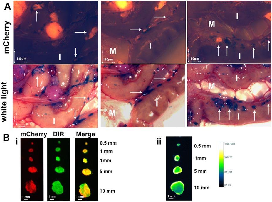 Specificity of detection is maintained with one time dosing of DIR-RGD-NP. (A) Upon establishment of tumors (ROI~40,000), mice were given a single dose of DIR-RGD-NP (“higher dose” indicated in Table 1; n = 4). Stereoscopic images show detection of micrometastasis by white light. White arrows point to micrometastasis. M, mesentery; I, instestines. (B) i, <em>Ex vivo</em> imaging and colocalization of mCherry and DIR signals in dissected tumors; ii, quantification of DIR intensity and penetration in cross-sectioned tumors. Source: <strong>Novel approach for the detection of intraperitoneal micrometastasis using an ovarian cancer mouse model</strong> by Alvero et al., <em>Scientific Reports</em>, Jan. 2017.