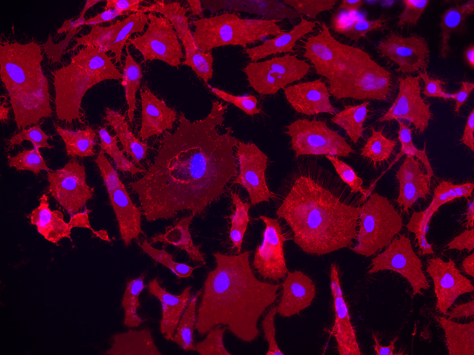 Live HeLa cell plasma membrane staining using DiR (Cat No. 22070). Nuclei were co-stained with Hoechst 33342 (Cat No. 17530). 
