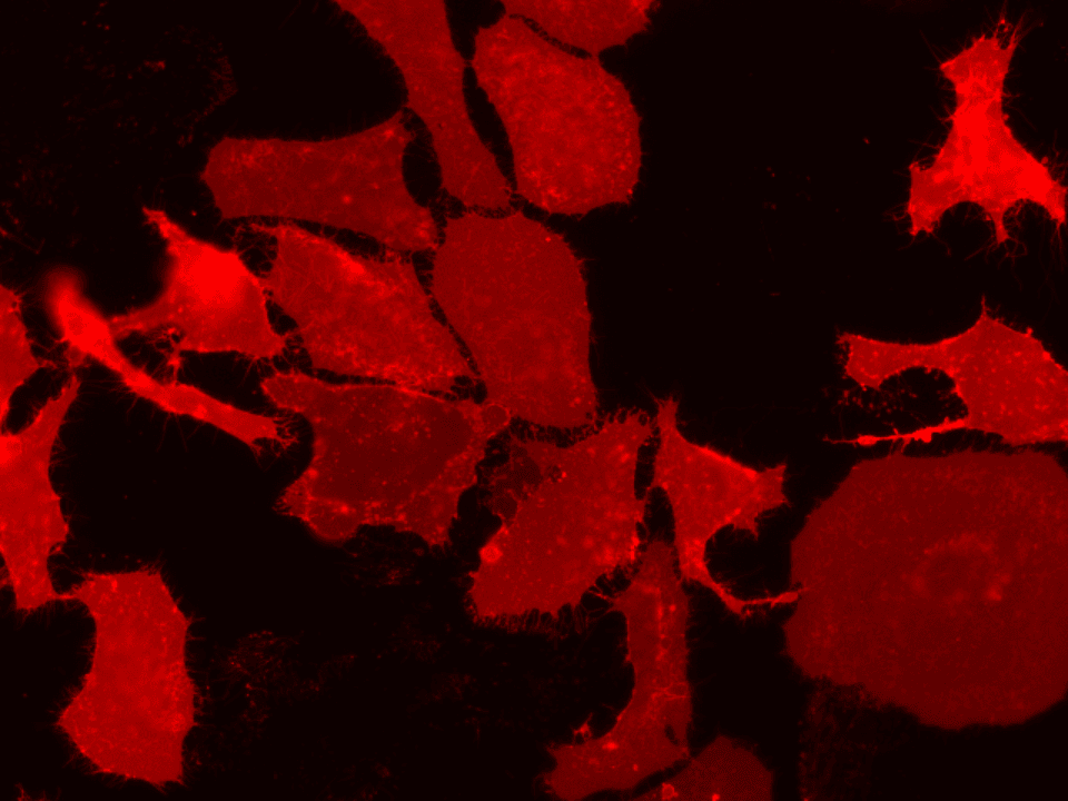 Live HeLa cell plasma membrane staining using DiR (Cat No. 22070). 