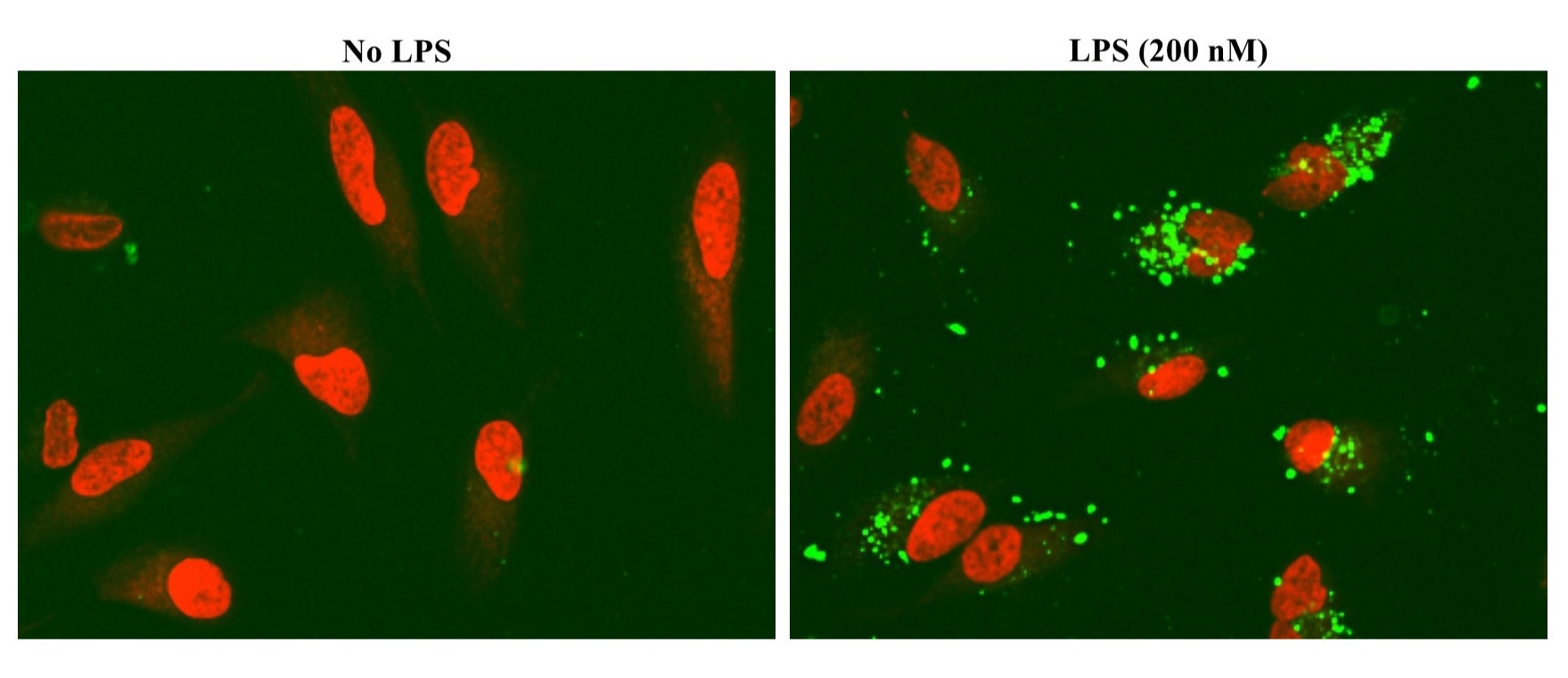 Effects of LPS treatment on cellular uptake of 5-FAM beta amyloid 1-42 (Cat# 81111) in HeLa cells. HeLa cells were incubated with 5-FAM–labeled beta-amyloid (1–42) (Cat# 81111) in the presence or absence of LPS (200 nM) for 20 h at 37 °C. Cells were subsequently stained with Nuclear Red LCS1 (Cat# 17542) and imaged using FITC and Cy5 filter sets. LPS treatment increased intracellular punctate 5-FAM fluorescence relative to untreated controls, consistent with enhanced cellular uptake and/or accumulation of beta-amyloid (1–42).