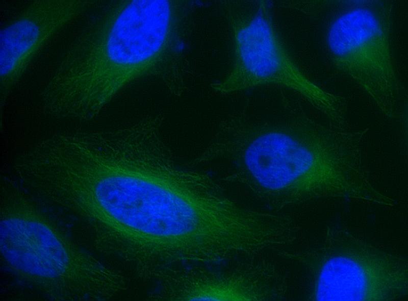 HeLa cells were incubated with rabbit anti-tubulin followed by FITC goat anti-rabbit IgG (H+L). Cell nuclei were stained with Hoechst 33342 (Blue, Cat# 17530).